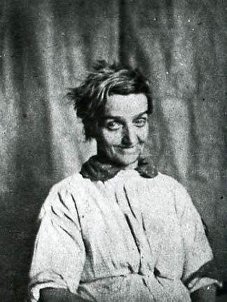 Психиатрический портрет пациентки, ~1850-е